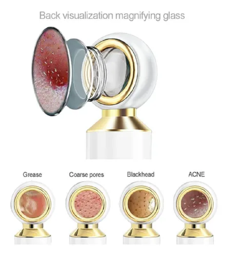 Miniatura 2 de Extractor De Puntos Negros Lupa